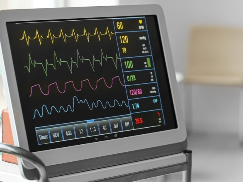 What is an ECG Test - Here's What To Know About it