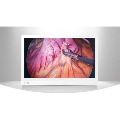 BENQ 27-inch 4K medical display for endoscopes and operating rooms SE27205